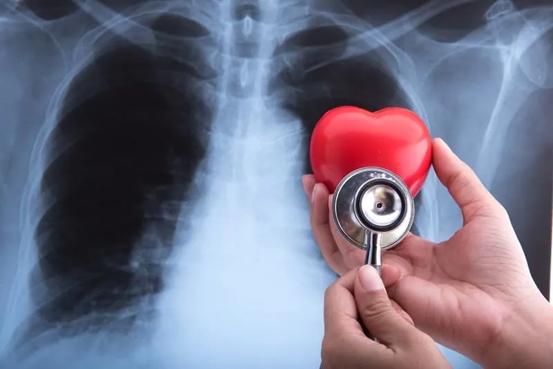 Tumores cardiacos y pulmonares
